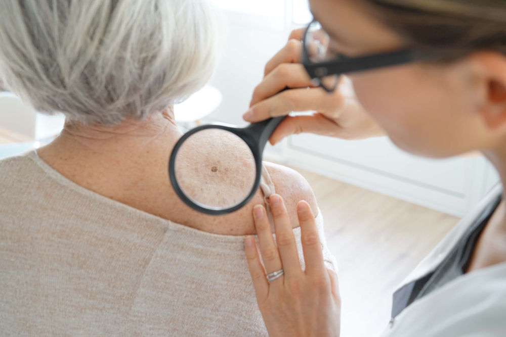 Doctor checking patient's skin for cancerous spots